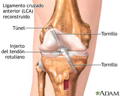 Cuidados postoperatorios