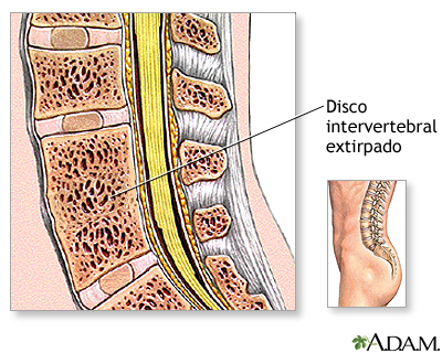 Cuidados postoperatorios