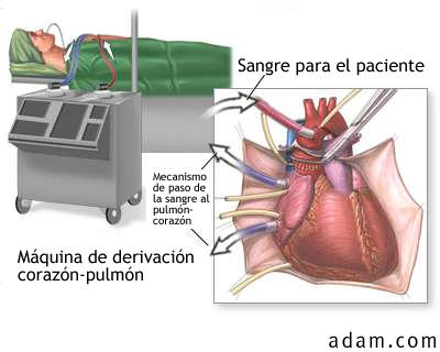 Procedimiento