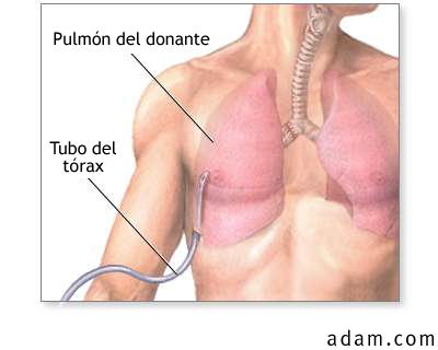 Cuidados postoperatorios