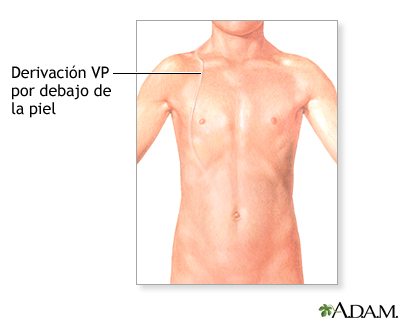 Cuidados postoperatorios