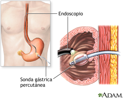 Procedimiento (segunda parte)