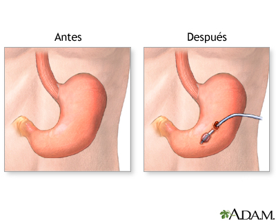 Cuidados postoperatorios