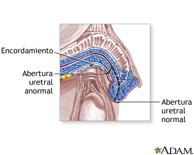 Procedimiento