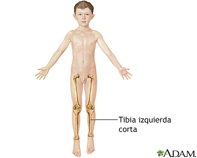 Indicaciones