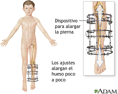 Cuidados postoperatorios