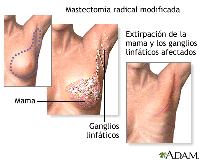 Procedimiento (segunda parte)