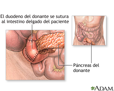 Procedimiento (primera parte)