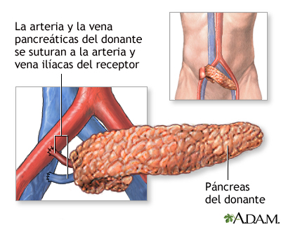 Procedimiento (segunda parte)