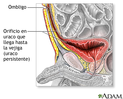 Indicaciones