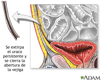 Procedimiento