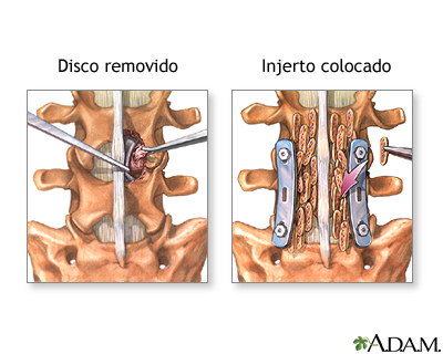 Procedimiento (segunda parte)