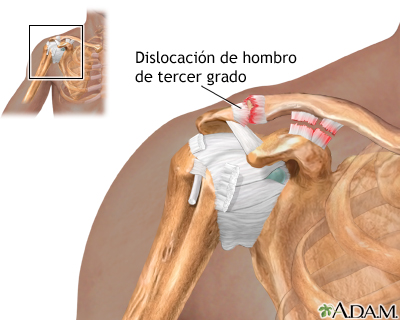 Indicaciones (segunda parte)