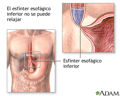 Indicaciones