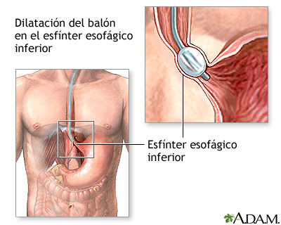 Procedimiento (primera parte)