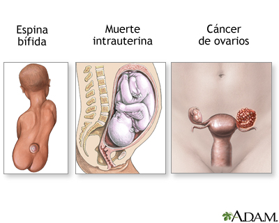 Resultados