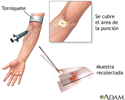 Procedimiento