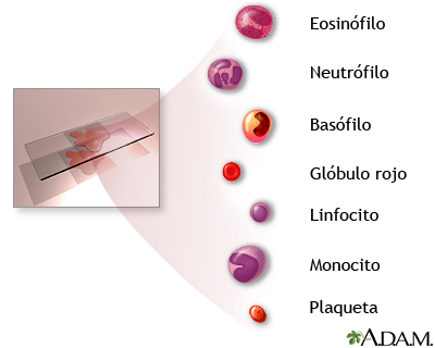 Indicaciones