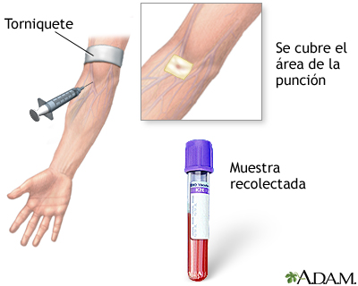 Procedimiento