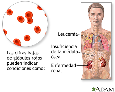 Resultados (primera parte)