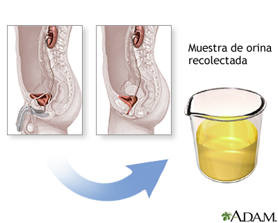 Procedimiento