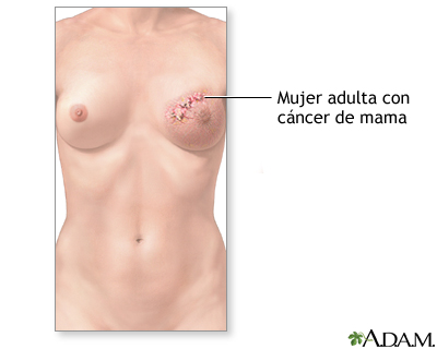 Indicaciones (primera parte)