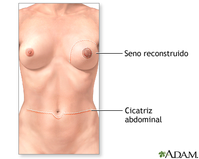 Cuidados postoperatorios