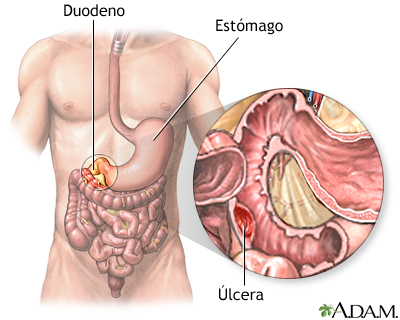 Indicaciones