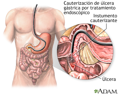 Procedimiento (segunda parte)