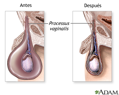 Cuidados postoperatorios