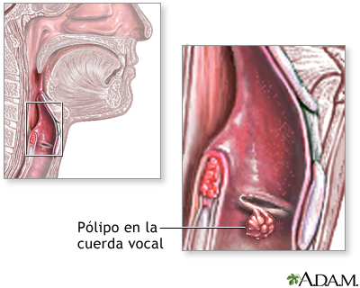 Indicaciones