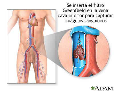 Procedimiento