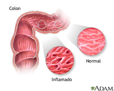 Indicaciones