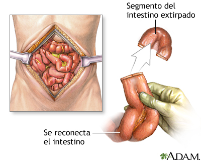 Procedimiento