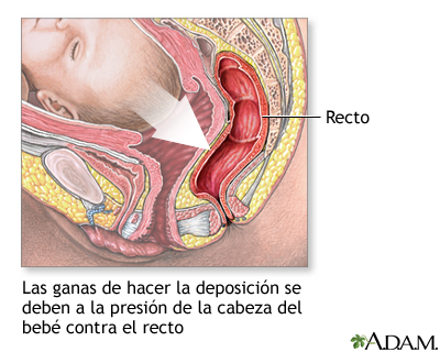 Parto de emergencia