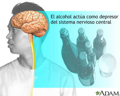 Alcoholismo