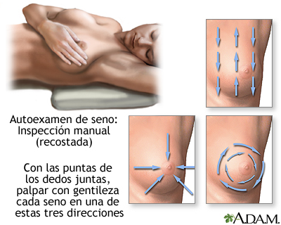 Autoexamen de seno