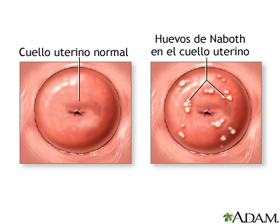 Huevos de Naboth