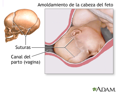 Moldeamiento de la cabeza fetal