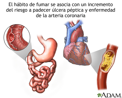 Tabaco y enfermedad vascular