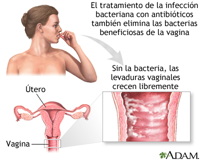 Infección secundaria