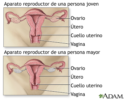 Menopausia