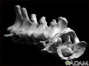 Vértebra cervical del cuello