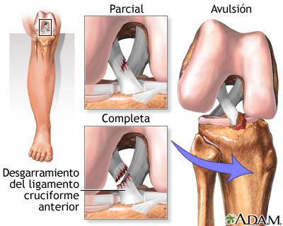 Grados de LCA