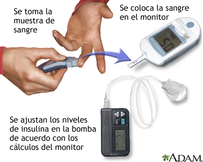 Examen de glucosa