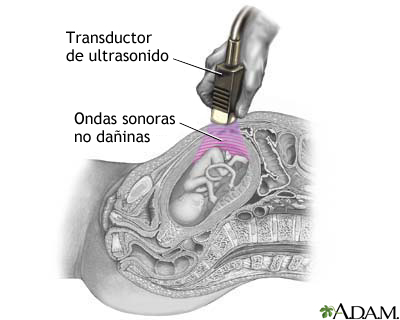 Ultrasonido