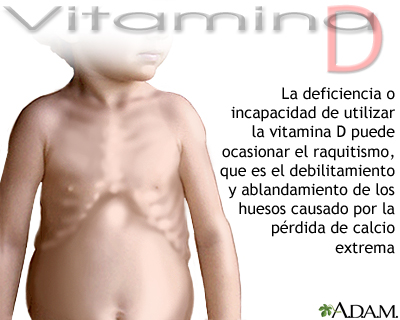 Déficit de vitamina D