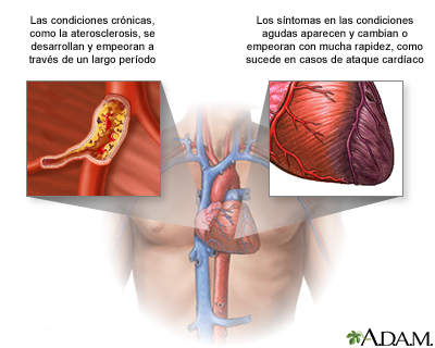 Condiciones agudas contra crónicas