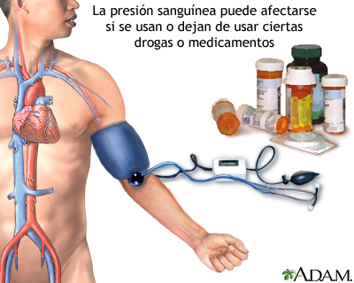 Hipertensión inducida por drogas