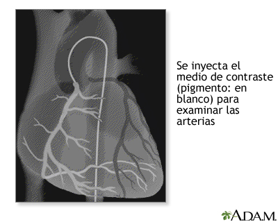 Procedimiento (quinta parte)